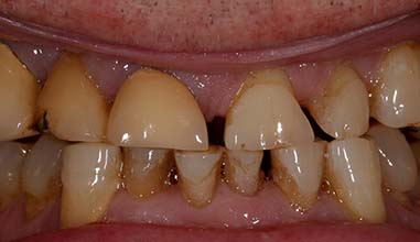 Before - Altondental