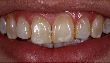 Before - Altondental Dental