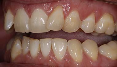 Before - Altondental Dental