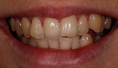 Before - Altondental