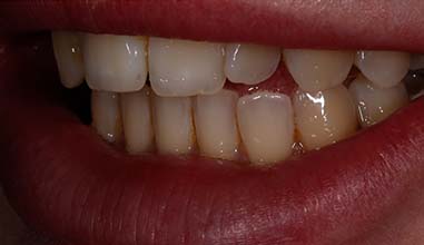 Before - Altondental Dental