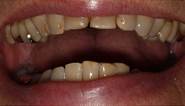 Before - Altondental Dental