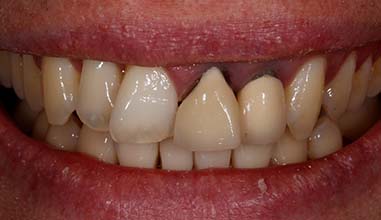 Before - Altondental