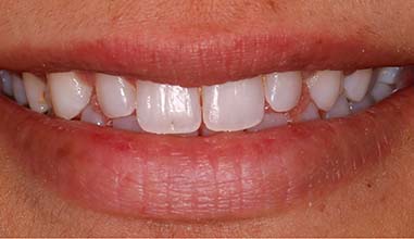 Before - Altondental