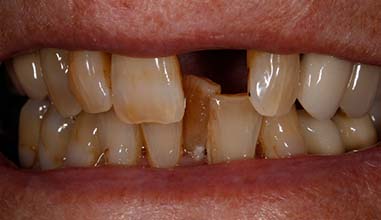 Before - Altondental