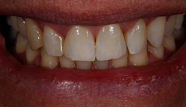 Before - Altondental Dental