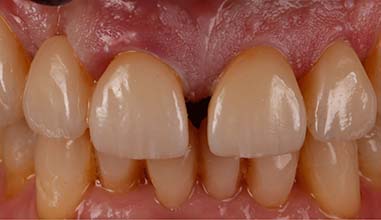 After - Altondental