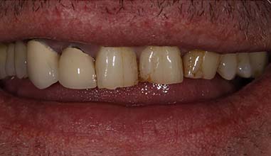 Before - Altondental