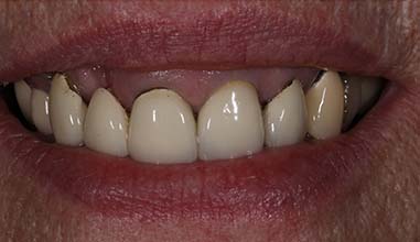 Before - Altondental